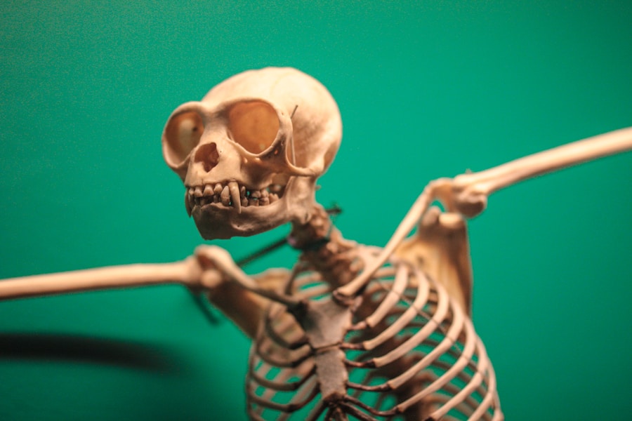 Photo "Causes of osteomyelitis"
