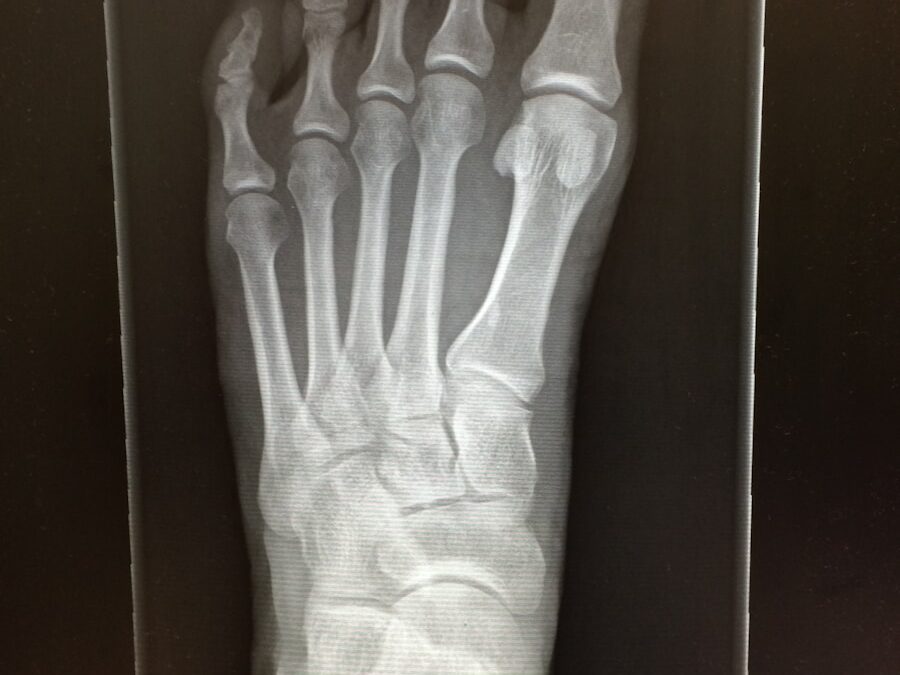 Photo "Diagnosis of osteomyelitis"