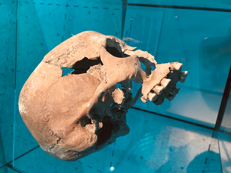 Photo "Prevention of bone necrosis"