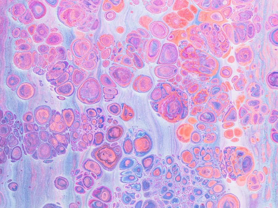 Photo Treatment of bone marrow inflammation