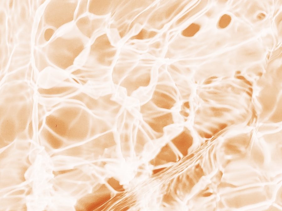Photo "Causes of bone marrow inflammation"