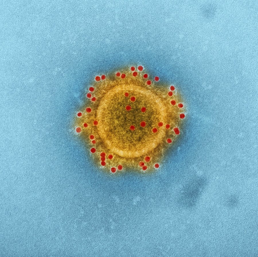 Photo Diphtheria diagnosis
