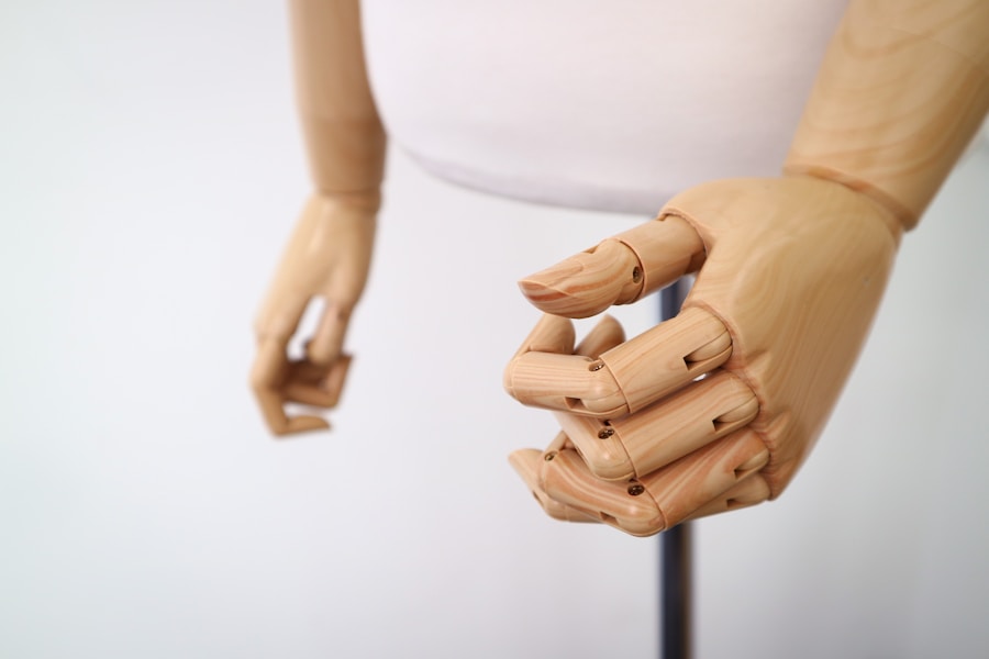 Photo "Dupuytrens contracture treatment options"