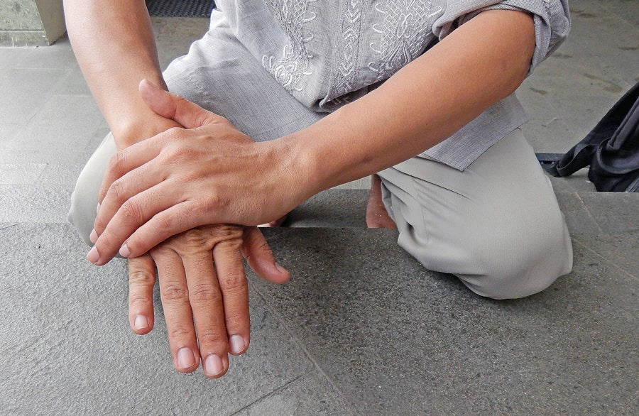 Photo "Dupuytrens contracture rehabilitation"