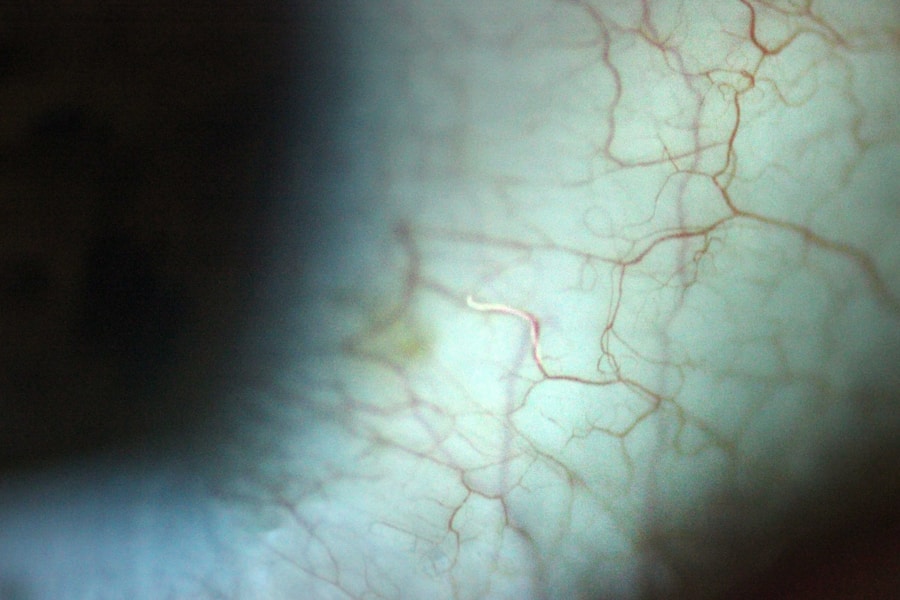 Photo "Causes of tympanic membrane perforation"