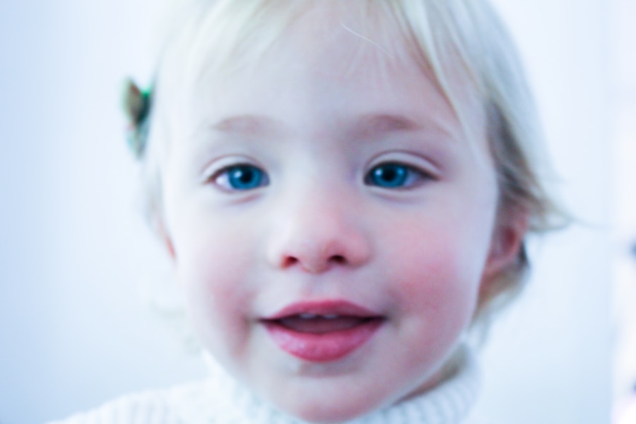 Photo Symptoms of Down syndrome