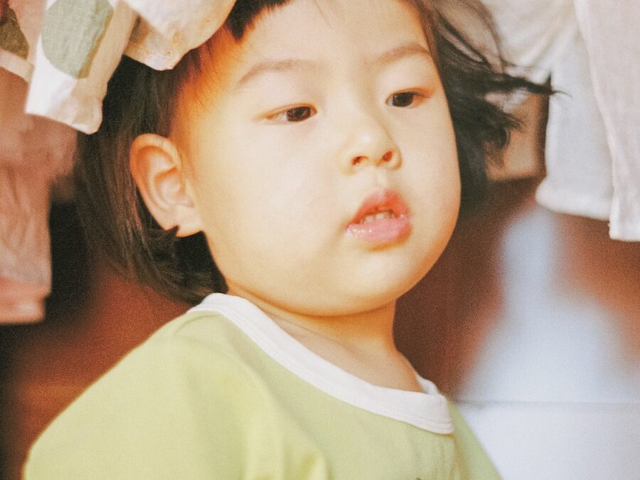 Photo Causes of Down syndrome