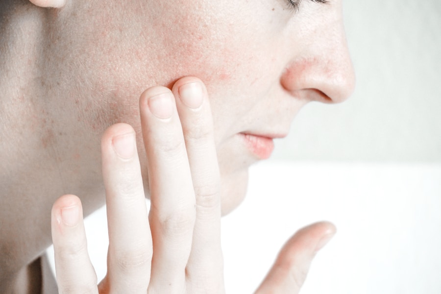 Photo "Causes of eczema"