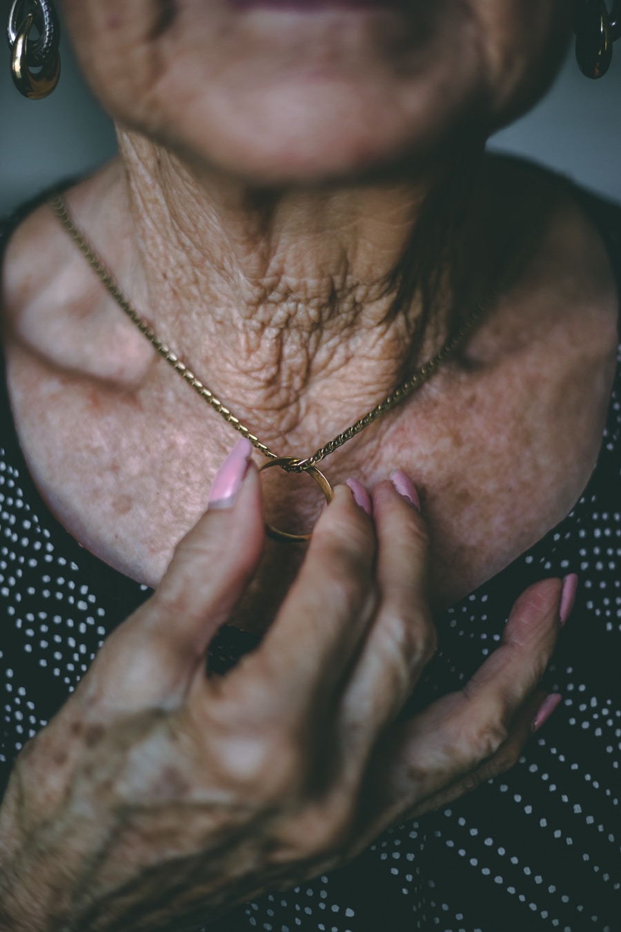 Photo Eczema symptoms
