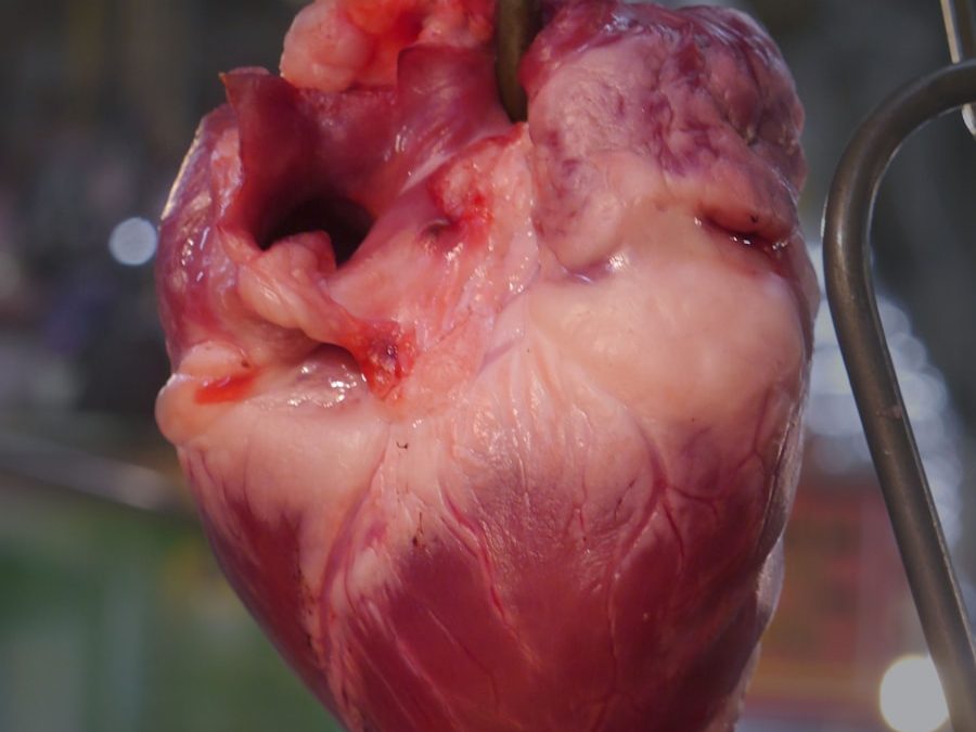 Photo "Diagnosis of endocarditis"
