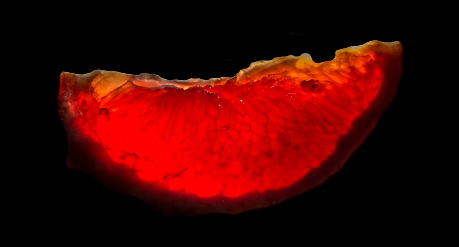 Photo "Prognosis of gallbladder cancer"