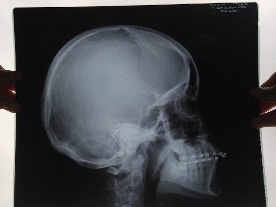 Photo "Diagnosis of head and neck tumors"