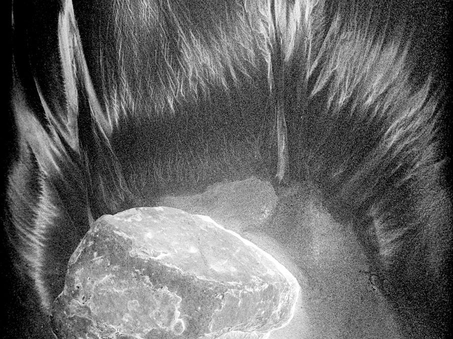 Photo "Treatment of head and neck tumors"