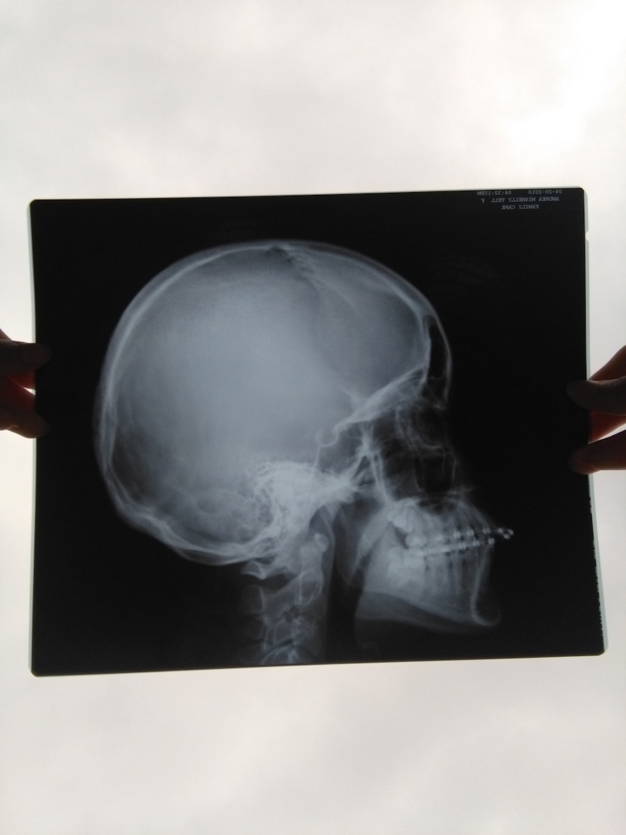 Photo "Symptoms of head and neck tumors"