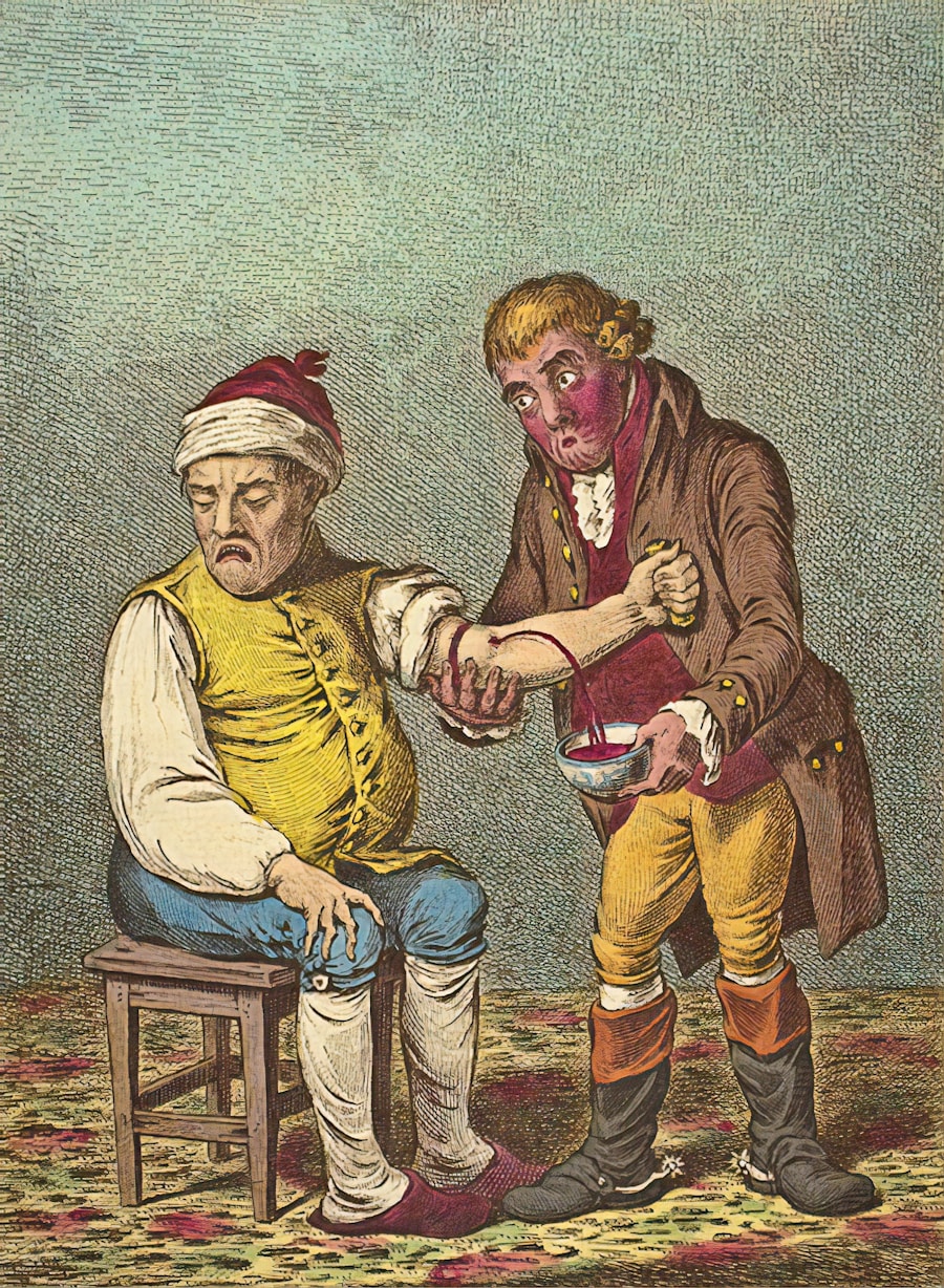 Photo Treatment of epilepsy