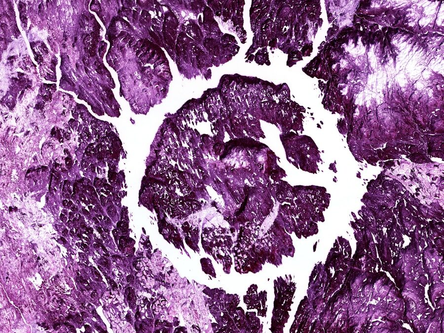 Photo "Diagnosis of epilepsy"
