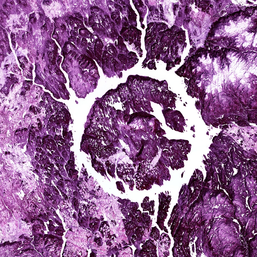 Photo "Diagnosis of epilepsy"