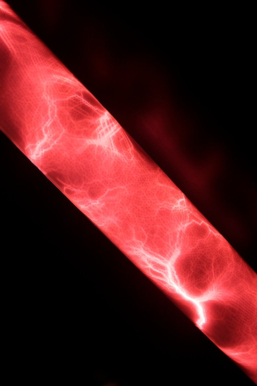 Photo "Risk factors for atherosclerosis"