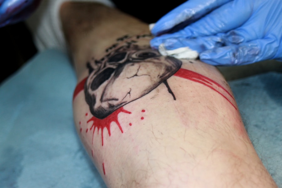 Photo "leg artery surgery"