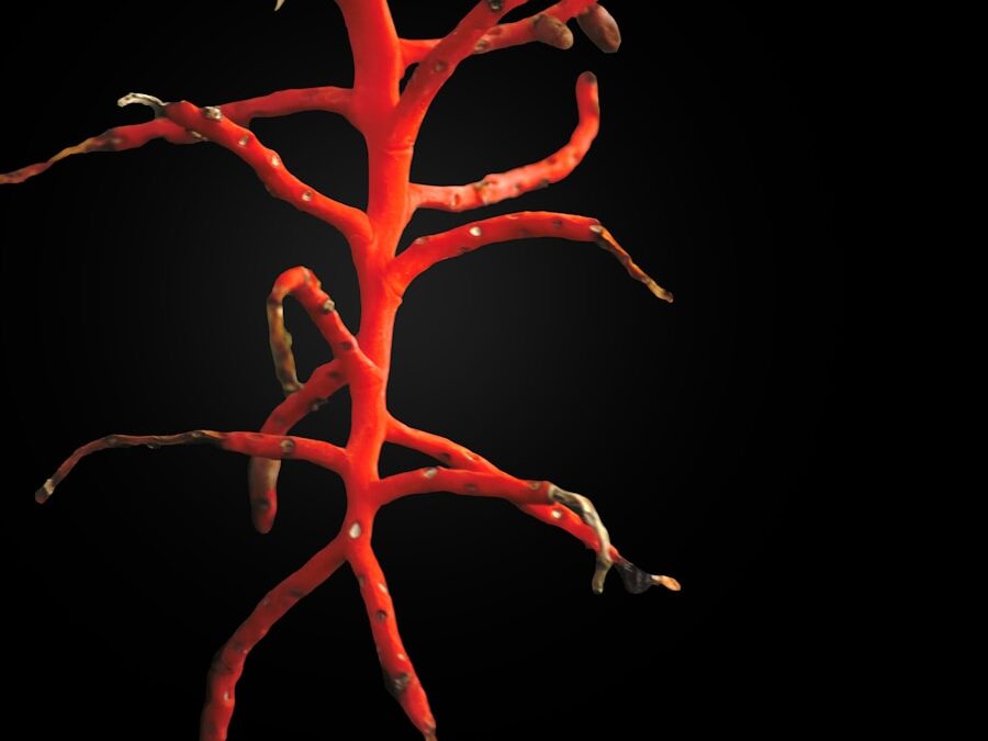 Photo "symptoms of arteriosclerosis"