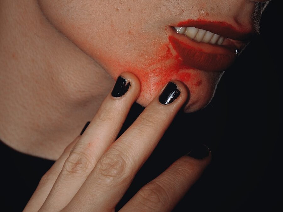 Photo Complications