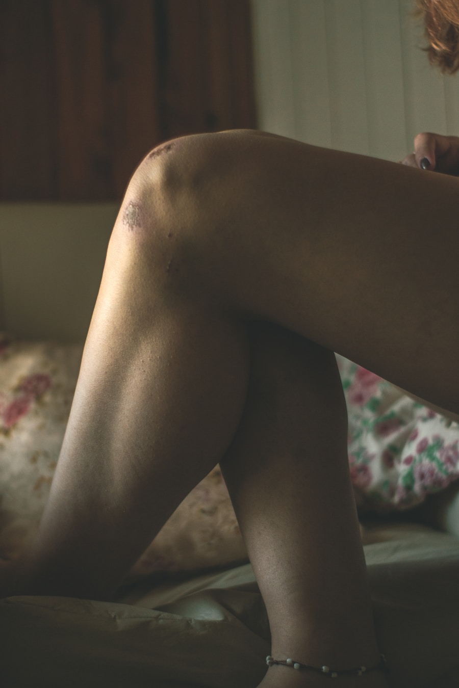 Photo "Symptoms of narrowing in the leg"