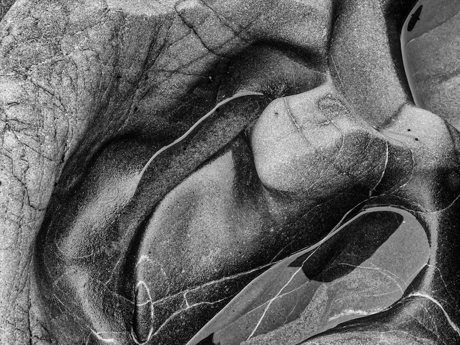 Photo Heart atherosclerosis