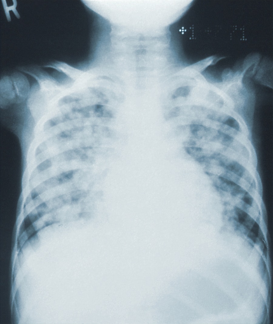 Photo "Diagnosis of tetralogy of Fallot"