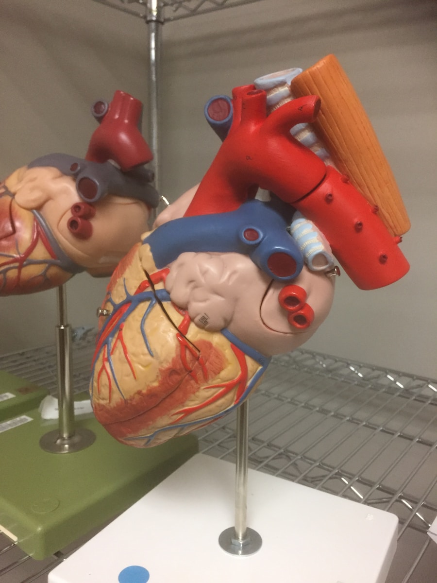 Photo "heart vascular surgery"