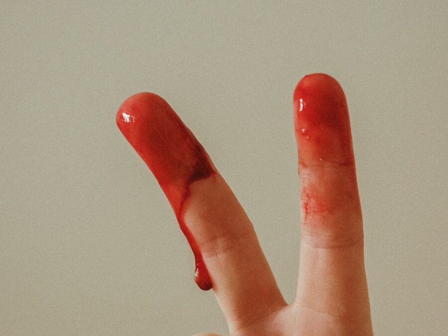 Photo "Erythromelalgia okay"