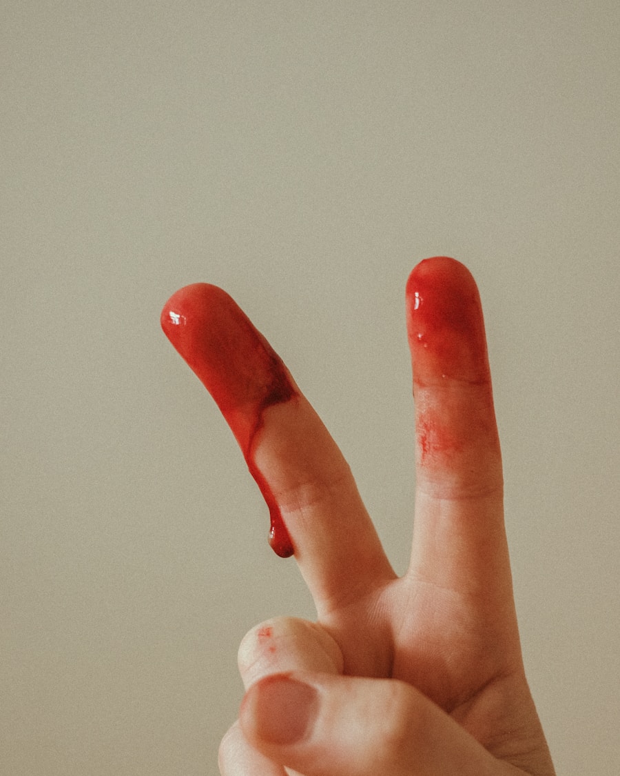 Photo "Erythromelalgia okay"