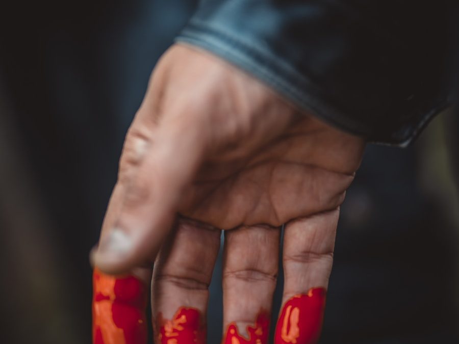 Photo "Erythromelalgia remedies"