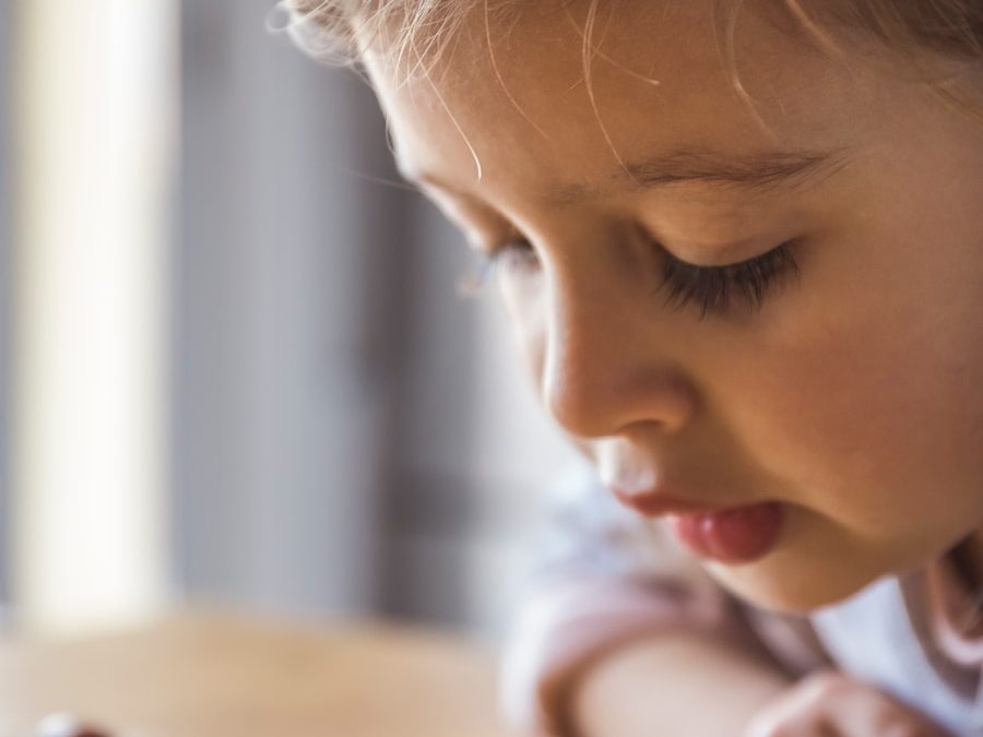 Photo Diagnosis of food allergy