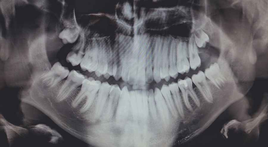 Photo "Types of periodontal disease"