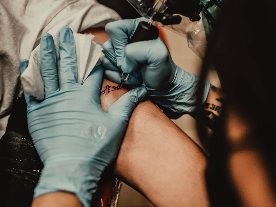 Photo Tartar removal