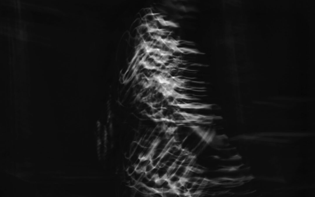Photo MRI scan