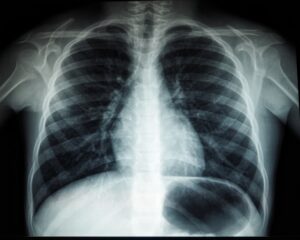 Photo CT scan