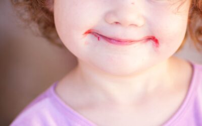 Photo "treatment of tooth decay in children"