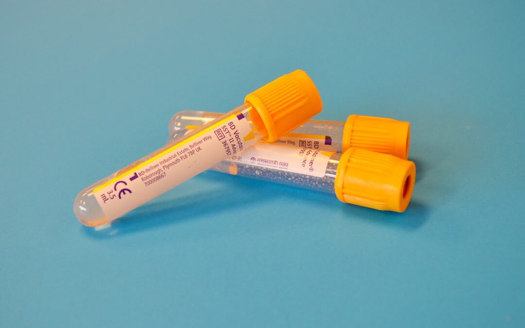 Photo Blood test