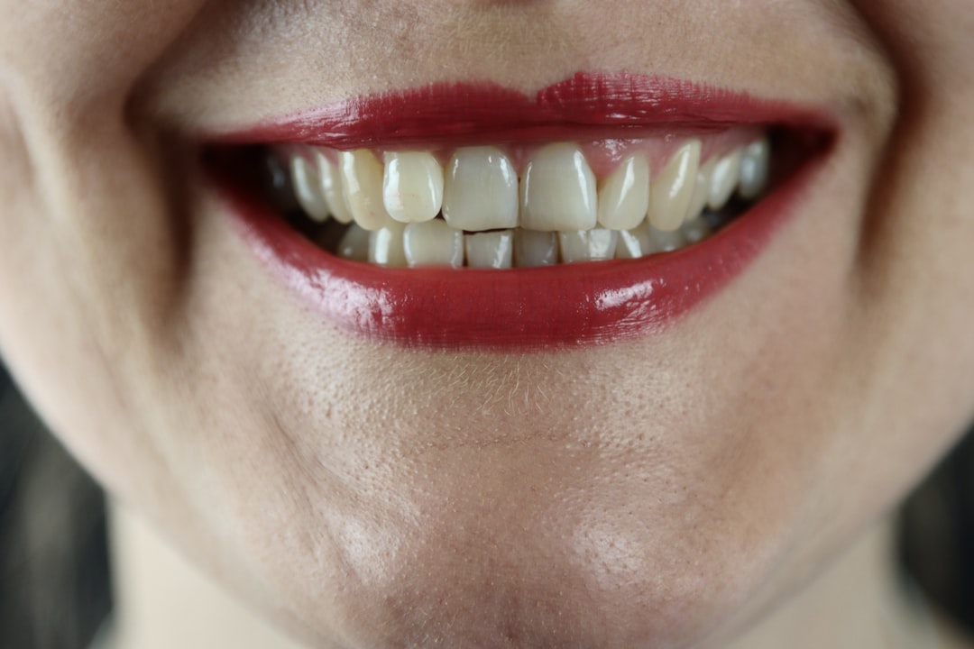 Photo Mouth sore