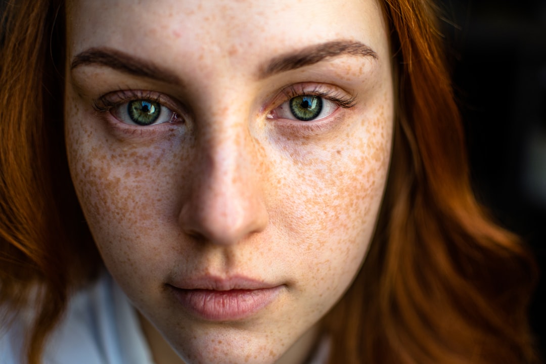 Photo Dark spots