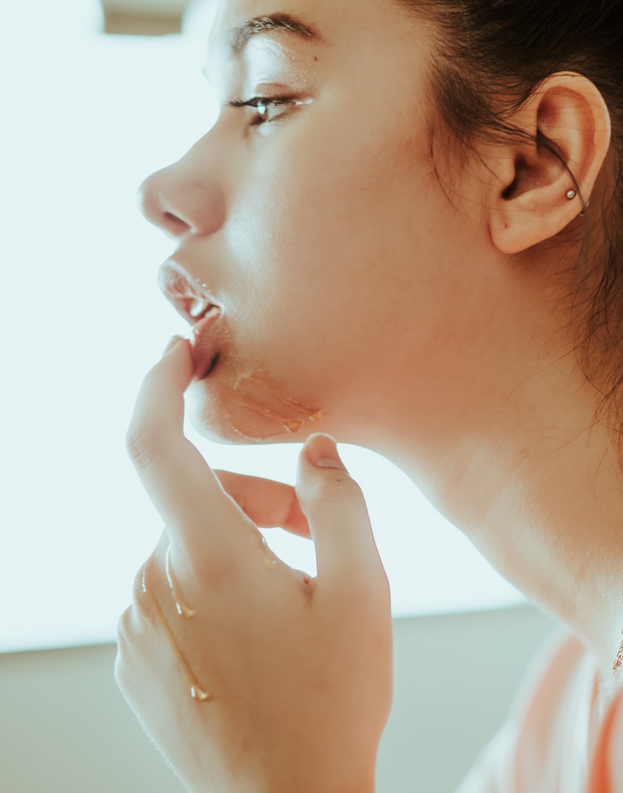 Photo Symptoms of tonsillitis