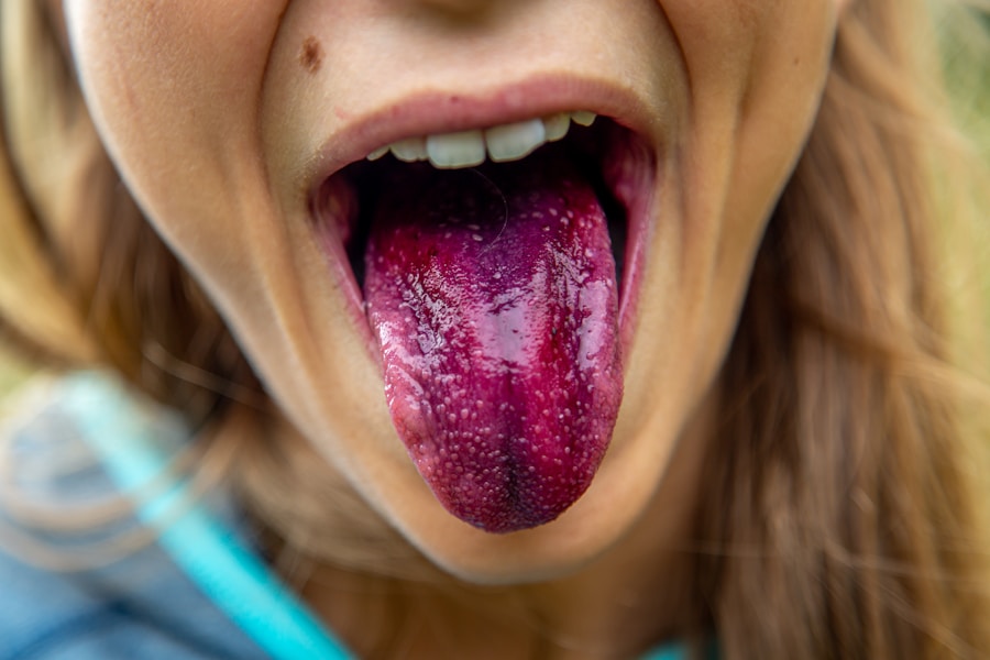 Photo Laryngitis in adults