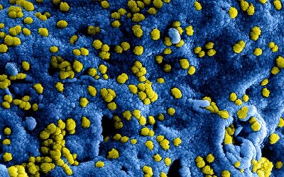 Photo Urinary tract infection