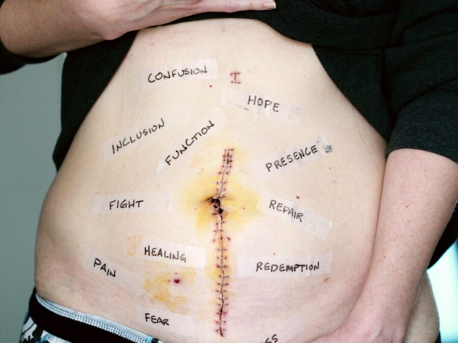 Photo "Diagnosis of gastroparesis"
