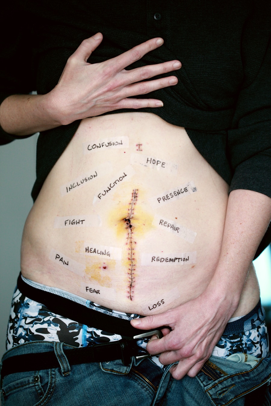 Photo "Diagnosis of gastroparesis"