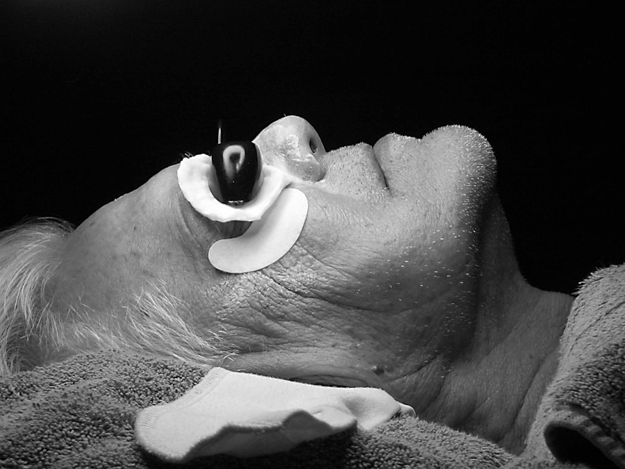 Photo Treatment of laryngeal cancer