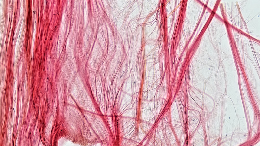 Photo Inflamed tendon