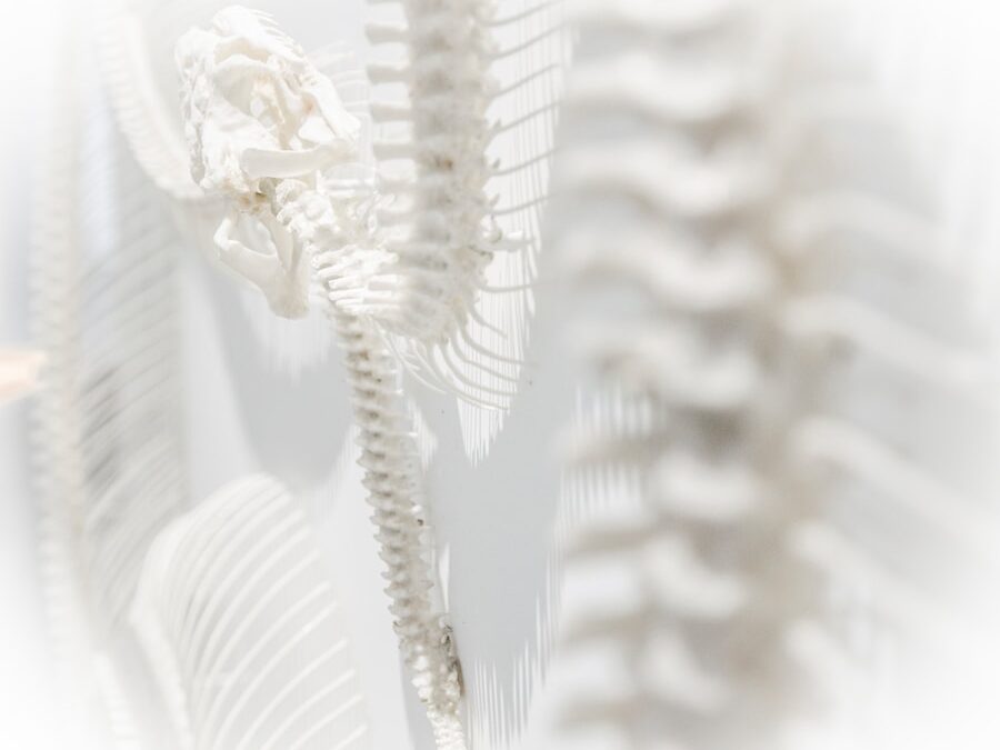 Photo "Causes of scoliosis"