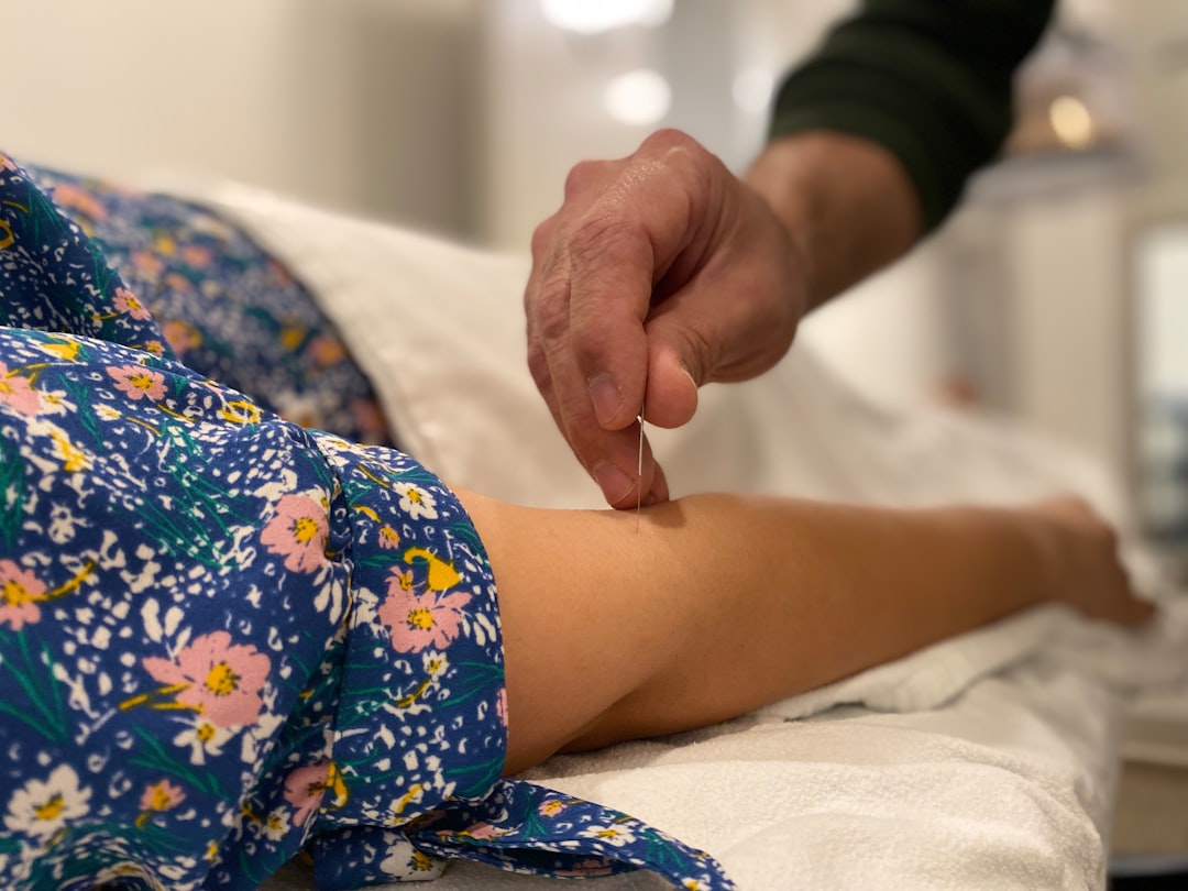Photo Acupuncture